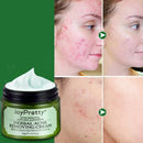 Creme Facial Antiacne - Tratamento para Espinhas